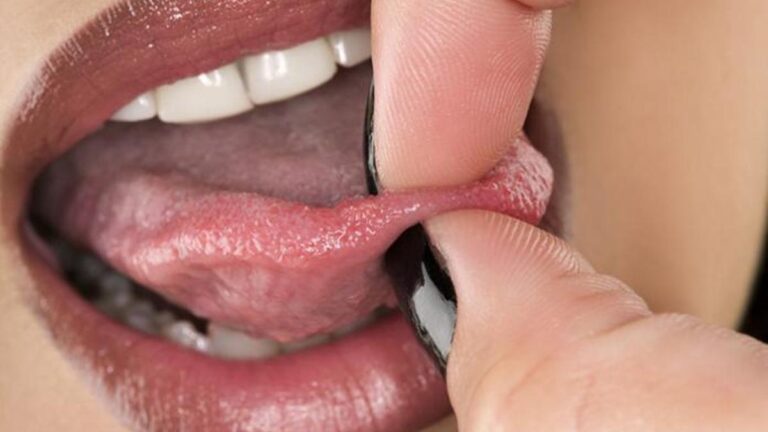 Diliniz sık sık uyuşuyorsa nedeni bu olabilir! Dil Uyuşması Nedir, Neden Olur? Dilde Uyuşma Belirtileri Nelerdir, Nasıl Geçer?